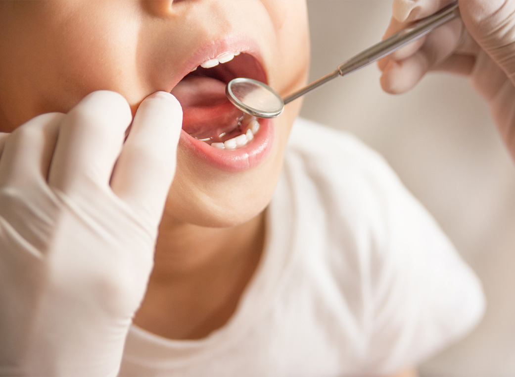 小児矯正ついて